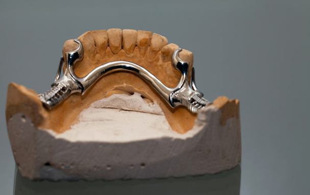 Zirconium Porcelain Tooth plate in Dentist Store - Foto, imagen