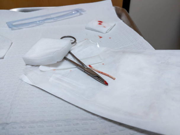 Pohled na antikoncepční implantát, čerstvě odstraněný, sedící na lékařském stole s gázou - Fotografie, Obrázek