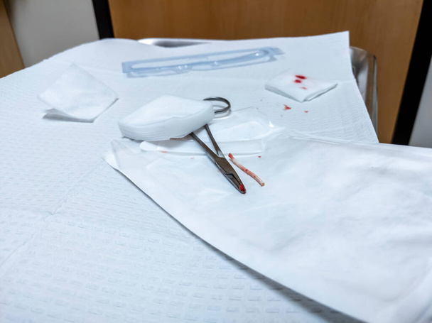 Pohled na antikoncepční implantát, čerstvě odstraněný, sedící na lékařském stole s gázou - Fotografie, Obrázek