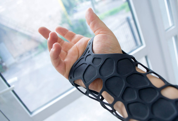 Elindeki toz 3D yazıcıya basılmış siyah ortopedik plastik protez. Ortopedik alçıtaşı kol hizasında.. - Fotoğraf, Görsel