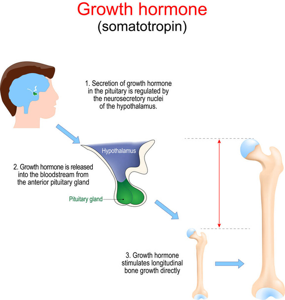 La hormona del crecimiento estimula el desarrollo del hueso. Primer plano de una glándula pituitaria que produce somatotropina. La hormona del crecimiento estimula el crecimiento óseo longitudinal directamente. Ilustración vectorial. cartel explica en detalle cómo funciona la HGH. Diagrama educativo - Vector, Imagen