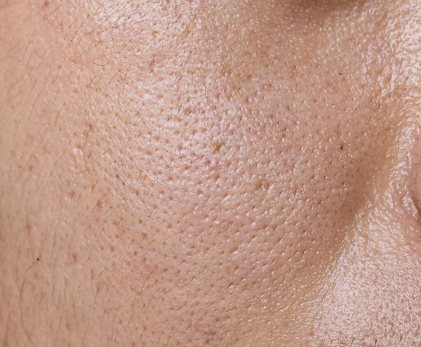 Fair skin with wide pores in face of Southeast Asian, Myanmar or Korean adult young man. Closeup view. - Photo, image