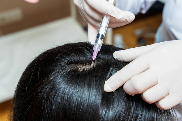 Procedimiento de mesoterapia. El médico cosmetólogo hace el procedimiento de mesoterapia en la cabeza de las mujeres. Fortalecer el cabello y su crecimiento. - Foto, imagen