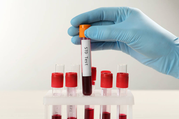 Scientist taking tube with blood sample and label STD Test from rack at white table, closeup - Photo, Image