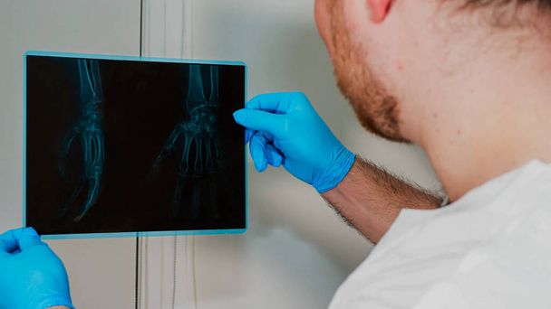 X-ray injury of the wrist. A male doctor carefully examines a hand injury, a medical professional looks at an X-ray of a bone injury - Fotografie, Obrázek