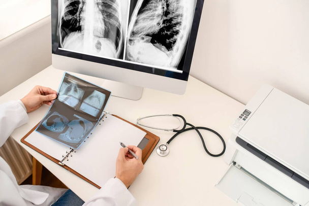 Vue d'ensemble du jeune homme radiologue médecin analise les rayons X et le film de tomographie par ordinateur et faire une description médicale dans le cahier - Photo, image