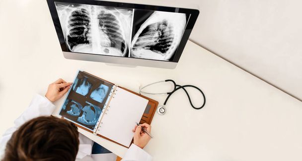 若い男の放射線医のトップビューは、 X線とコンピュータ断層撮影フィルムを分析し、ノートブックに医療X線の説明を行います.テキストのスペースをコピー - 写真・画像