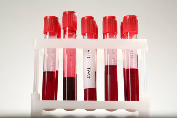 Tubes with blood samples in rack on white background. STD test - Φωτογραφία, εικόνα