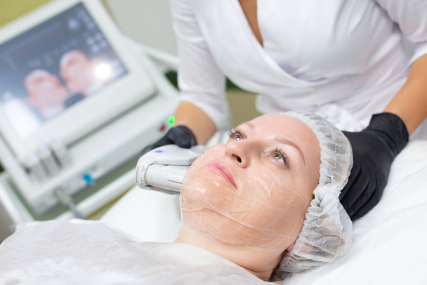 A woman in a cosmetology office receives a SMAS lifting procedure. Non-surgical ultrasound facelift, rejuvenation, moisturizing, getting rid of wrinkles, skin tone and elasticity - Fotoğraf, Görsel