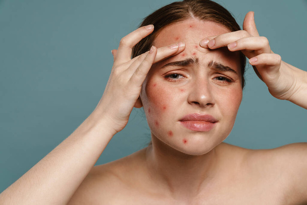 Ginger shirtless woman frowning and squeezing pimple on her face isolated over blue background - Photo, Image