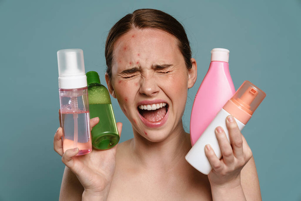 Ginger shirtless woman with pimples screaming while showing cosmetics isolated over blue background - Foto, Imagem