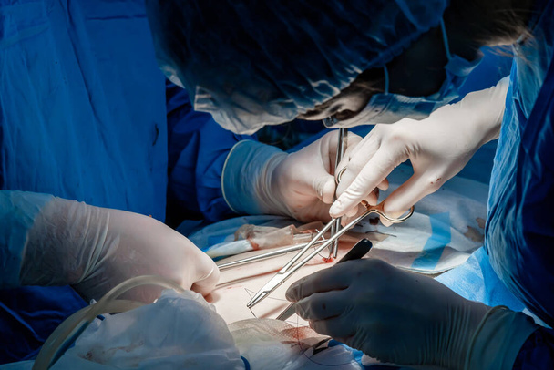Doctors use medical instruments and metal thread to suture human skin. - 写真・画像