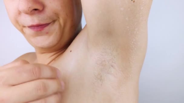 The man shows his sweaty armpits to the camera. Close-up of sweat drops. Gland problems. Hyperhidrosis, increased sweating, anhidrosis. Concept of treatment for violations of the mechanisms secretion. - Footage, Video