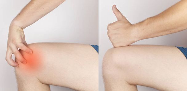 Πριν και μετά. Στα αριστερά, ένας άντρας κρατιέται από ένα τραυματισμένο γόνατο, και στα δεξιά, οι γιατροί έχουν ήδη θεραπεύσει έναν ασθενή. Ρήξη τενόντων γόνατος, μυών, τραυματισμού μηνίσκου, κατάγματος οστών ή σχισμής - Φωτογραφία, εικόνα