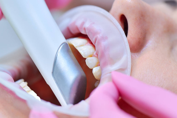 Primer plano del dentista haciendo la exploración dental 3D de los dientes de los pacientes. Concepto de salud y estomatología. De cerca. - Foto, imagen