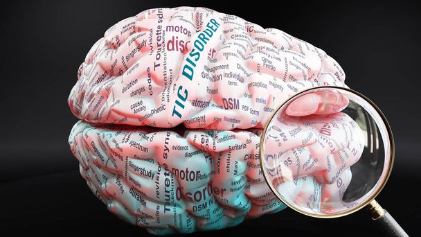 Tic desordem no cérebro humano, um conceito que mostra centenas de palavras cruciais relacionadas com Tic desordem projetada em um córtex para demonstrar plenamente ampla extensão desta condição, ilustração 3d - Foto, Imagem