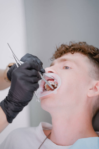 fiatal srác kap fogszabályzó orvosi felszereléssel - Fotó, kép