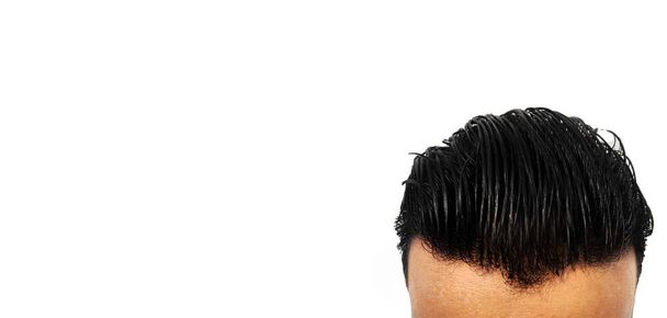 Чоловічий темний прапор для волосся з копіювальним простором. Молоді чоловічі волосини на фоні темного кольору. Банер концепції кольору волосся та облисіння
 - Фото, зображення