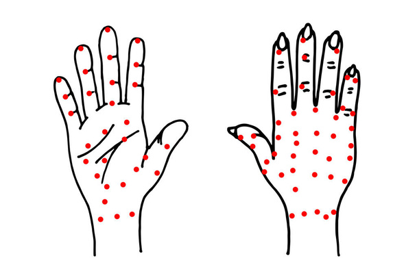 Hand palm and dorsal side sketch. Alternative medicine and treatment. Chinese red points acupuncture scheme drawing. Medical vector illustration - Vector, Image