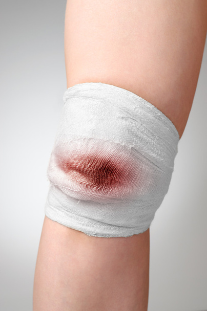 joelho ferido com bandagem sangrenta
 - Foto, Imagem