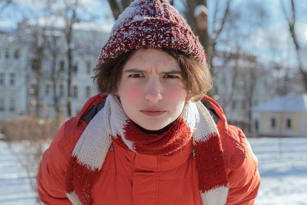 legrační dospívající dívka v teplém svěrací kazajce a pleteném klobouku a šále s červenými omrzlými tvářemi a nosem zamračeným nelibostí se dívá do kamery. Zmrazené nespokojené dítě v zimě slunečný mrazivý den - Fotografie, Obrázek