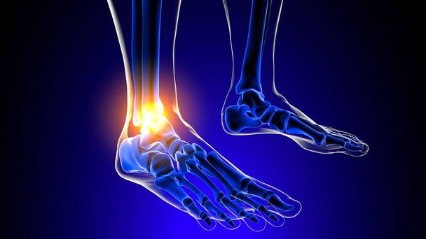 Anatomia del dolore articolare alla caviglia per concetto medico Illustrazione 3D - Foto, immagini