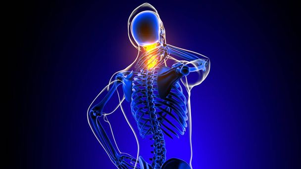 Ból stawów szyjnych kręgosłupa szyjnego Anatomia dla koncepcji medycznej 3D Ilustracja - Zdjęcie, obraz