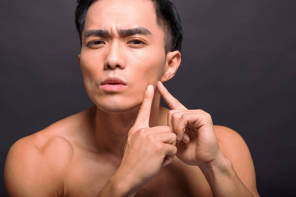 Handsome young man touching his face. Squeezing pimple. - Foto, afbeelding