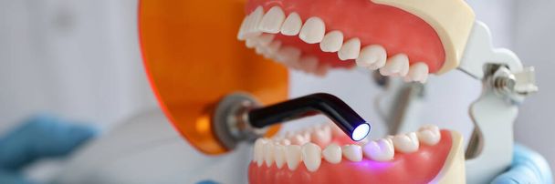 Docteur tient la mâchoire et la lampe UV dentaire pour remplir la mâchoire dentaire - Photo, image