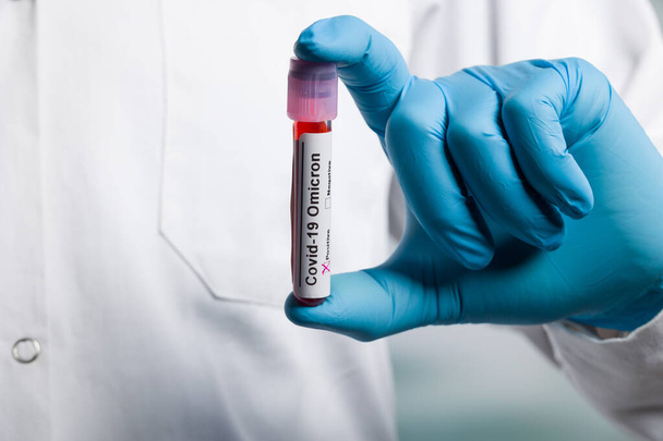 Gros plan des mains dans des gants médicaux tenant un tube à essai sanguin après analyse du virus avec des marqueurs de résultat omicron - Photo, image