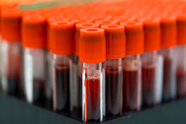 Medical blood diagnostic technology. Laboratory blood test tubes. - Foto, Imagem