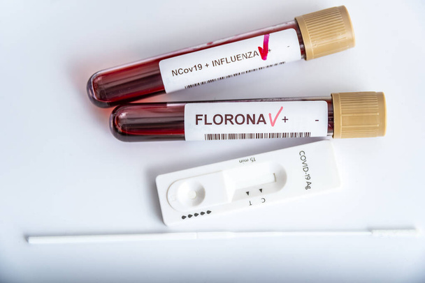 Blood samples of new variant OMICRON plus flu FLUORONE, covid19, coronavirus. Selective approach to the sample tube. - 写真・画像