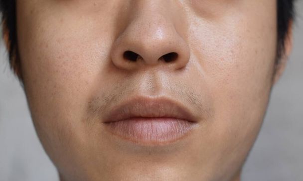 Visage huileux de jeune homme adulte sud-est asiatique, birman ou coréen. - Photo, image