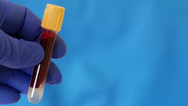 Container of human blood. Hand in blue nitrile glove holds test tube with blood - Filmati, video