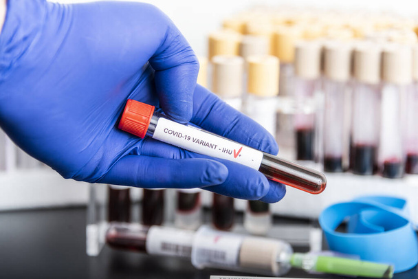 Doctors hands hold blood samples of the new variant IHU, covid19, coronavirus. Selective approach to the sample tube. - Photo, Image