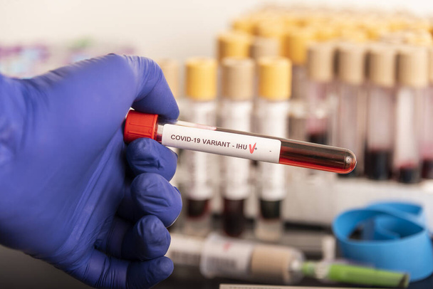 Οι γιατροί κρατούν δείγματα αίματος της νέας παραλλαγής του ΔΙΠΑΕ, covid19, coronavirus. Επιλεκτική προσέγγιση του σωλήνα δειγματοληψίας. - Φωτογραφία, εικόνα