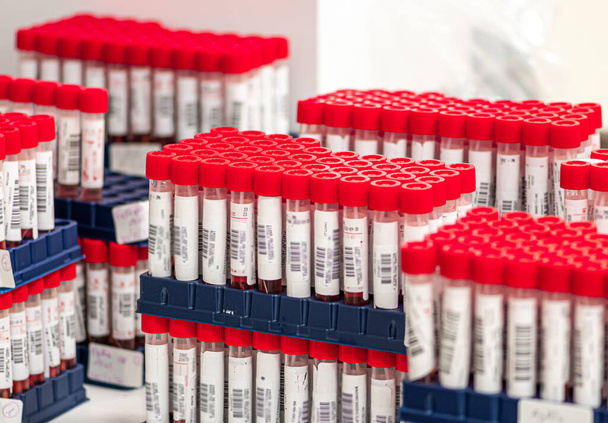 Tubos de ensaio PCR moleculares reais em linha, esfregaços nasais e orofaríngeos com reagente vermelho em frascos para injetáveis, testes para a doença infecciosa por Sars Cov-2, Covid-19 ou Coronavirus - Foto, Imagem