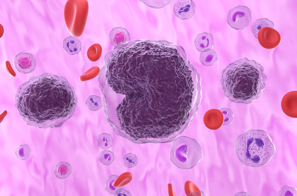 Non-hodgkin lymphoma (NHL) cells in the blood flow - closeup view 3d illustration - Fotó, kép