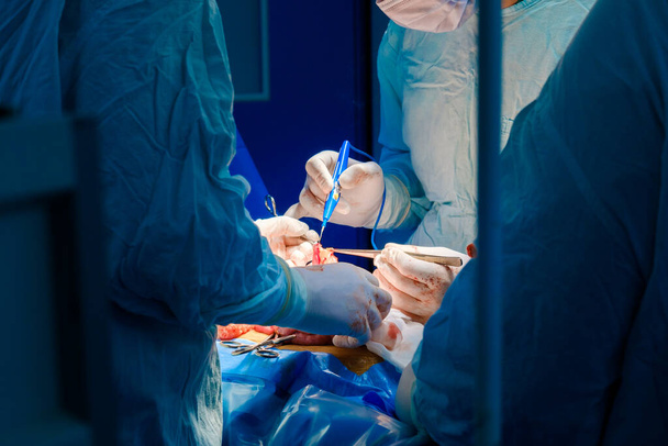The hands of surgeons in sterile gloves operate with an electrocoagulator. - 写真・画像