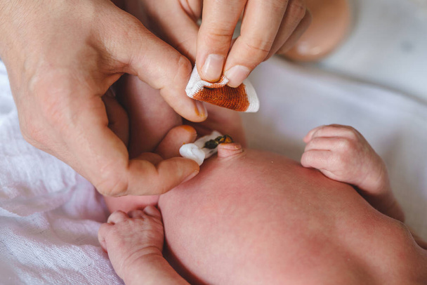 Hände eines unbekannten Mannes Vater kümmert sich um Nabelschnur mit Klemme Neugeborenes Säugling Pflege Eltern reinigen Nabel des Babys auf dem Bett zu Hause Reinigung mit Jod - Foto, Bild