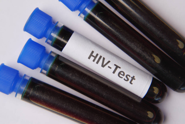 HIV blood test tube and prescription on table  - Foto, Imagen