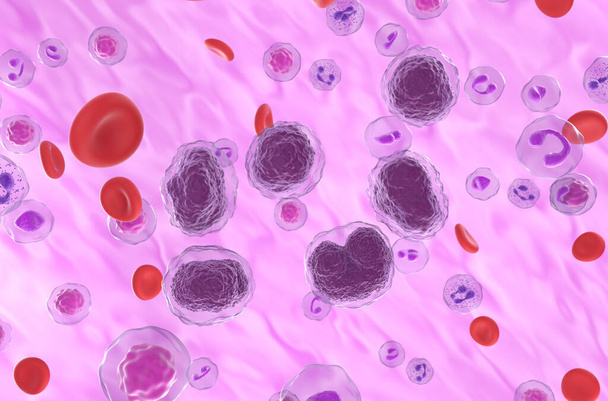 Non-hodgkin lymphoma (NHL) cells in the blood flow - isometric view 3d illustration - Fotó, kép