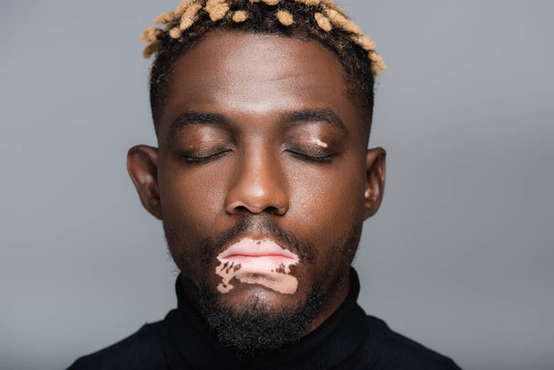 portrait of young african american man with vitiligo and closed eyes isolated on grey - Photo, image
