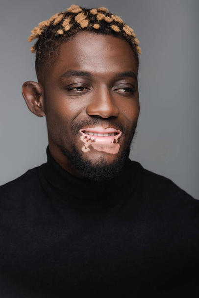 joyful african american man with vitiligo skin, wearing black turtleneck isolated on grey - 写真・画像