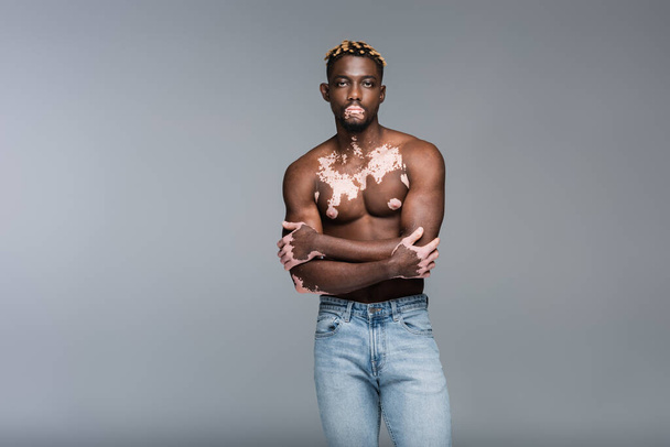 shirtless african american man with vitiligo skin posing with crossed arms isolated on grey - Photo, image