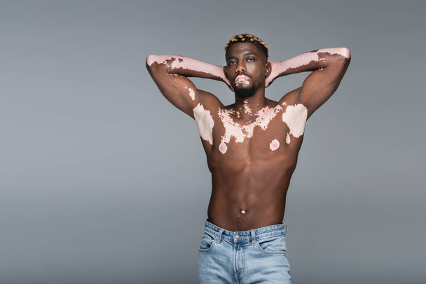 shirtless african american man with vitiligo skin and muscular torso posing with hands behind head isolated on grey - Foto, immagini