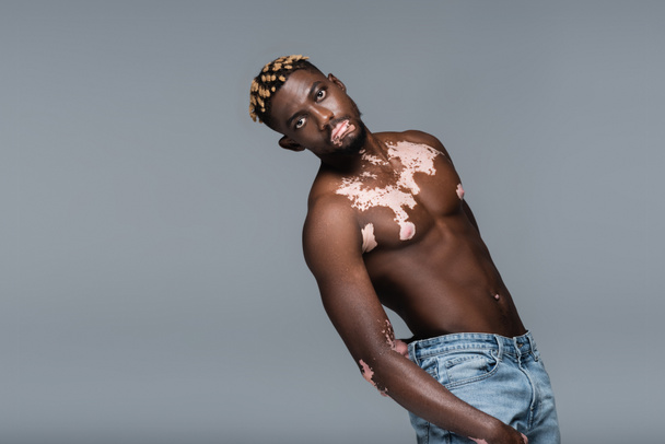 young and shirtless african american man with vitiligo skin and trendy hairstyle posing isolated on grey - Foto, Imagem