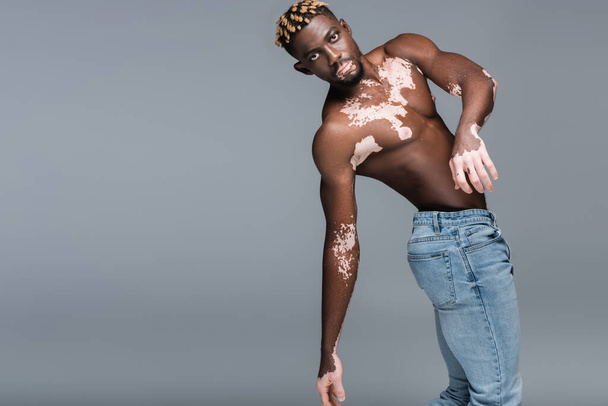 young african american man with vitiligo skin, muscular torso and trendy hairstyle posing isolated on grey - Foto, Imagen