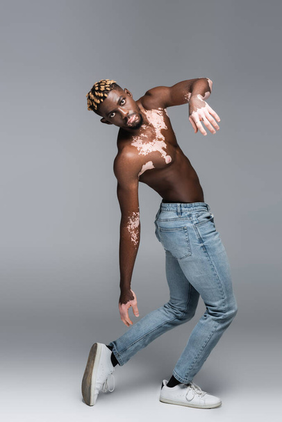 full length view of african american man with vitiligo and shirtless torso posing in jeans isolated on grey - 写真・画像