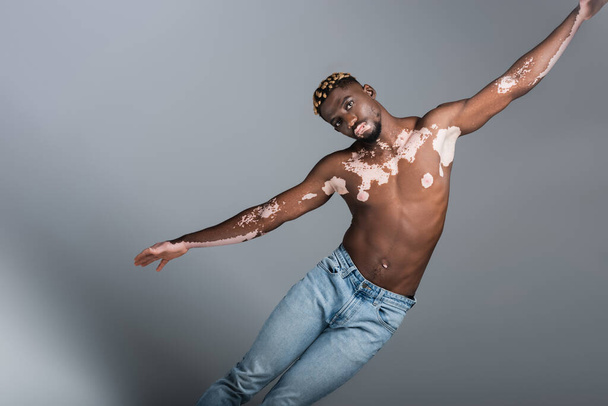 shirtless african american man with vitiligo and trendy hairstyle posing with outstretched hands isolated on grey - Fotografie, Obrázek